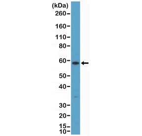 Anti-Cytokeratin 10, clone RM386
