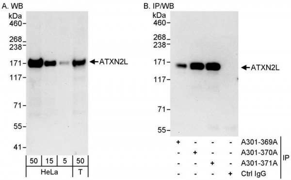 Anti-ATXN2L