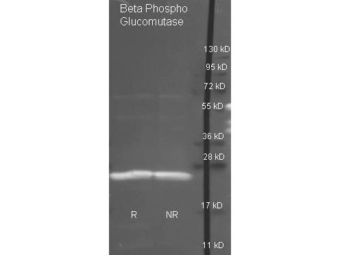 Anti-Phosphoglucomutase beta (Lactococcus Lacti)