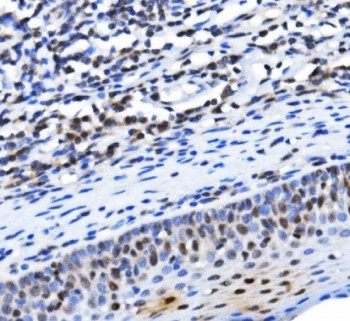 Anti-TBP associated factor 4 / TAF4