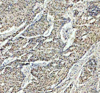 Anti-PSME3 / Proteasome activator complex subunit 3
