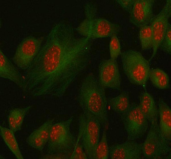 Anti-SSH3 / Slingshot homolog 3