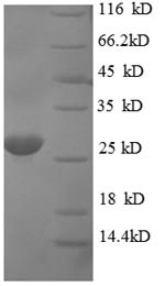 Apoptosis regulatory protein Siva (SIVA1), human, recombinant