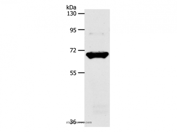 Anti-SLC33A1