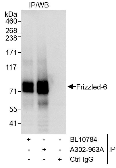Anti-Frizzled-6