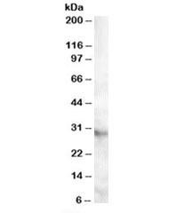 Anti-APOA1BP