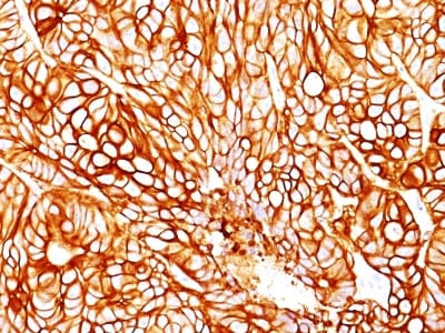 Anti-Cytokeratin 18(DA7), CF568 conjugate, 0.1mg/mL