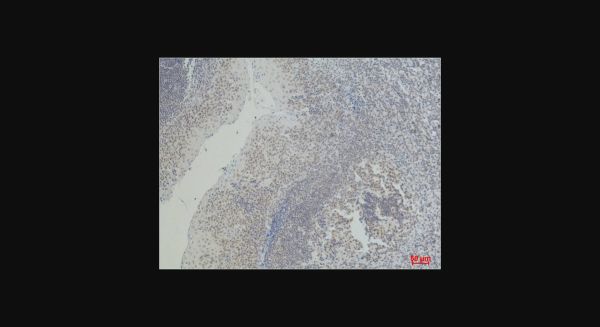 Anti-CD2, monoclonal