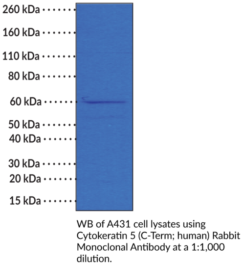 Anti-Cytokeratin 5 (C-Term, human) Rabbit Monoclonal Antibody (Clone RM226)