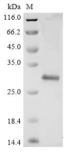 Replicase polyprotein 1ab (rep), partial, Avian infectious bronchitis virus, recombinant
