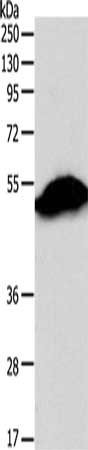 Anti-SIRT6