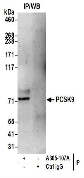 Anti-PCSK9