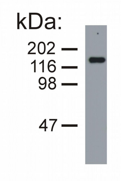 Anti-160kDa Neurofilament medium, clone NF-09