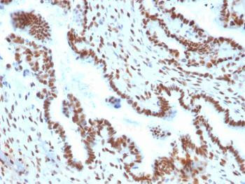 Anti-TLE1 (Synovial Sarcoma Marker) Monoclonal Antibody (Clone: TLE1/2051)