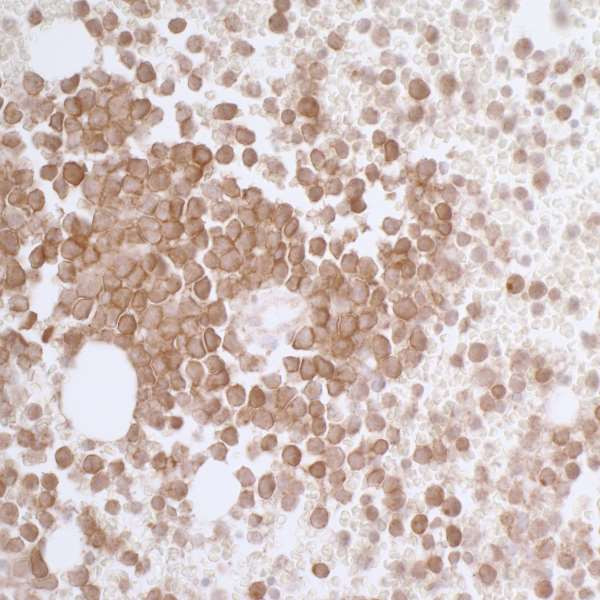 Anti-CD33 Recombinant Rabbit Monoclonal