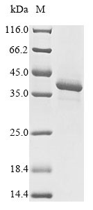 Plasmepsin-2, Plasmodium falciparum, recombinant