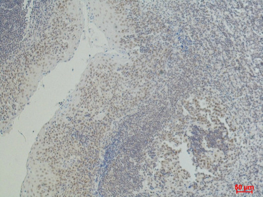 Anti-CD2