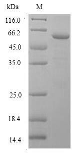 Deoxyribonuclease gamma (DNASE1L3), human, recombinant