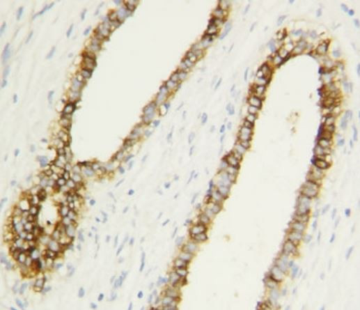Anti-Caspase-1