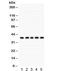 Anti-Cdk7