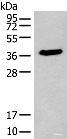 Anti-ACBD4