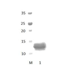 AHNAK2 PDZ Domain