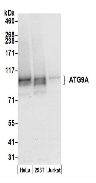 Anti-ATG9A