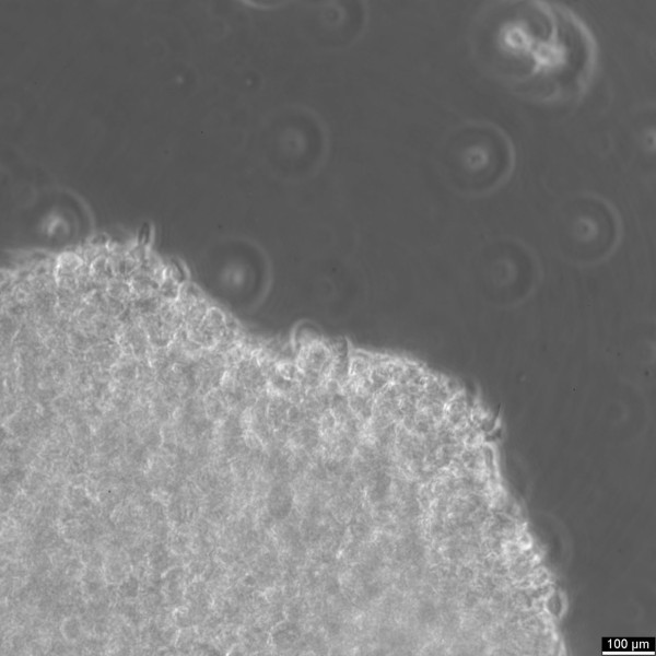 B-LCL-CDG1 Cells