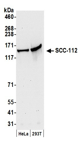 Anti-SCC-112