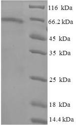 Tubulin beta-6 chain (TUBB6), human, recombinant