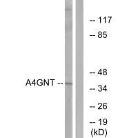 Anti-A4GNT