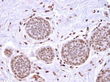 Anti-Mammaglobin A / SCGB2A2, clone MGB1/2682R