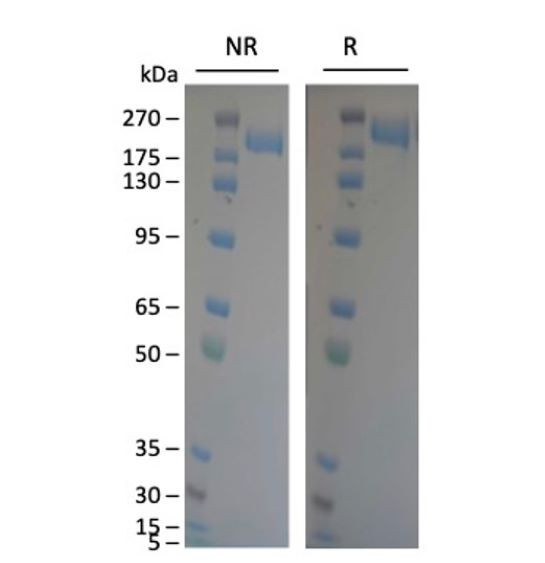 Spike Trimer (S1+S2) (BA.4.6, Omicron Variant), His-Tag (SARS-CoV-2) Recombinant