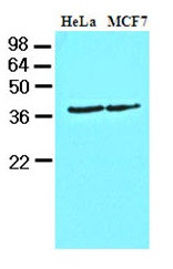 Anti-Casein Kinase 1 alpha, clone 2E2
