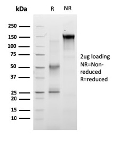 Anti-RET Proto-oncogene(RET/2663), CF640R conjugate, 0.1mg/mL