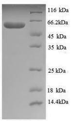 DNA polymerase I, thermostable (polA), partial, recombinant Thermus aquaticus