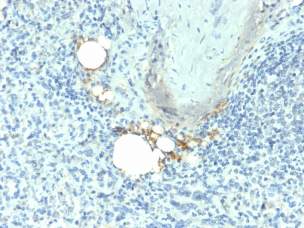 Anti-TRAcP (Tartrate-Resistant Acid Phosphatase) (Hairy Cell Leukemia Marker), clone ACP5/1070