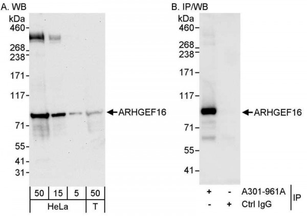 Anti-ARHGEF16