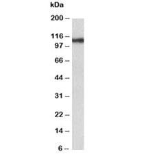 Anti-Thyroid Peroxidase