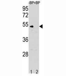 Anti-Cyclin B (CCNB1)