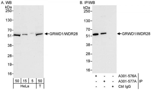 Anti-GRWD1/WDR28