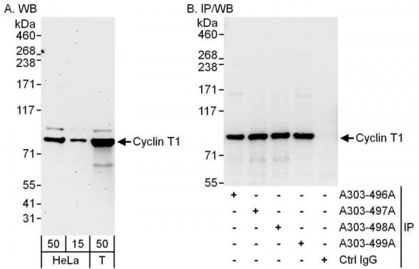 Anti-Cyclin T1