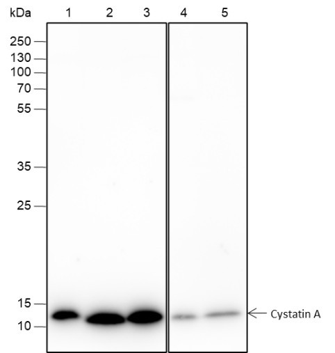 Anti-Recombinant Cystatin A, clone A204