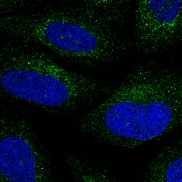 Anti-BCL2L14