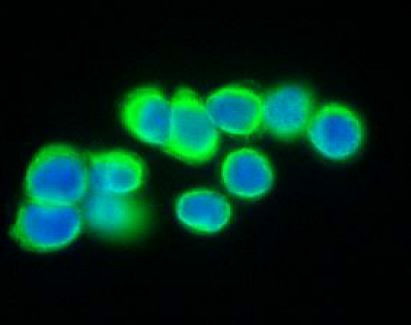 Anti-Cytokeratin 20, clone SQab1737