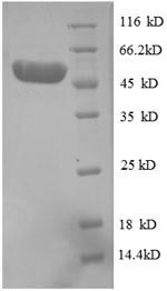 Proteasome activator complex subunit 3 (PSME3), partial, human, recombinant