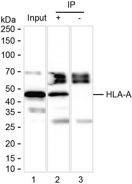 Anti-HLA-A