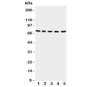 Anti-NRG1