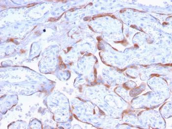 Anti-PAPP-A / Pappalysin-1 (Marker of Atherosclerosis and Aneuploid Fetus) Monoclonal Antibody (Clon