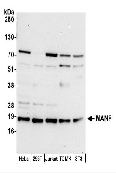 Anti-MANF